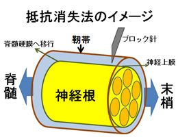 ブロック 神経 効き目 根 注射